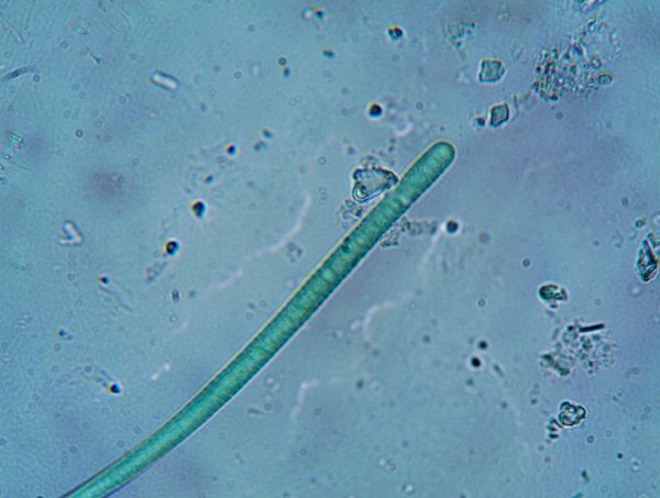 What are nematodes in plants? Are they beneficial or bad? What are nematodes in plants? Are they beneficial or bad?