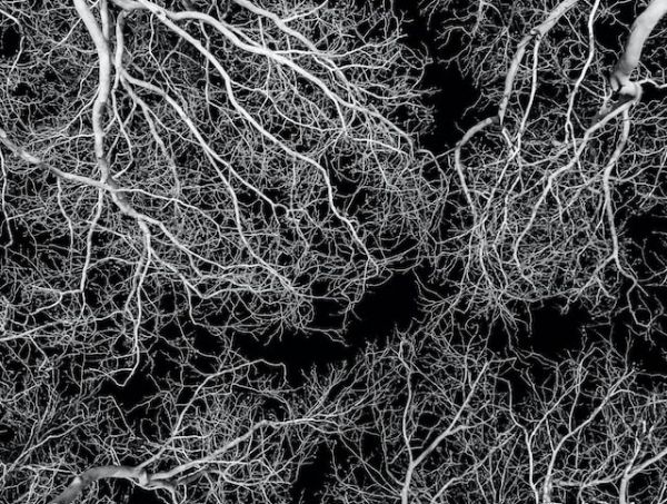 Mycorrhizae: What are they? Mycorrhizae: What are they?